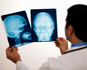 ⁂ Can you get x rays at a walk in clinic ⁂ Can you get x rays at a walk in clinic