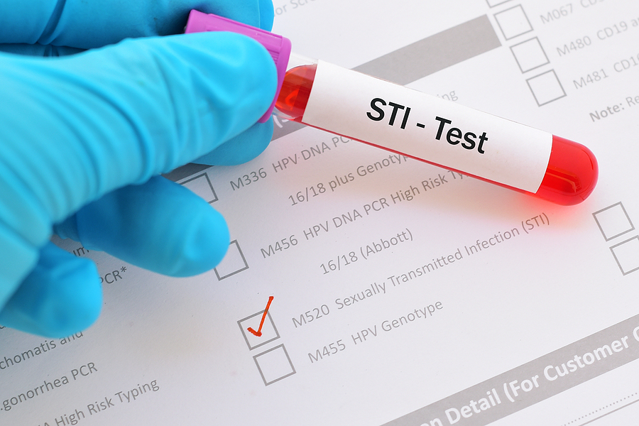 Same-Day STI Testing